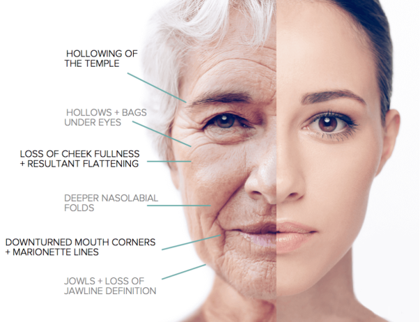 buy fillers online